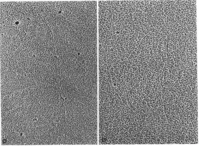 FIG. 1.cules Single-stranded RNA from bacteriophage RI 7, spread in the presence of urea