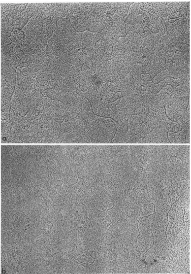 FIG. 3.(lenigth Replicative form (a) spread in the absenice ofurea anid (h) spread in the presenice of urea