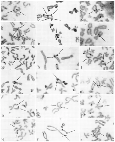 FIG. 10.at 48, Examples of isochromatid label int metaphases of HEK cells infected with labeled adenovirus type 12 and 72 hr after inifection