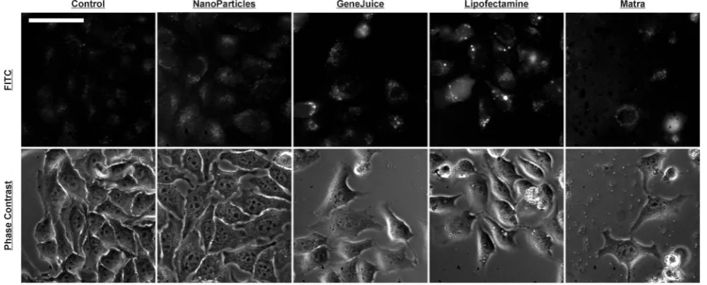 Figure 1. Fluoresence microscopy images showing localization of FITC-tagged hMT-IIa-specific sequence functionalizednanoparticles in live HeLa cells.absence (NanoParticles column) or the presence of the transfection reagents Matra, Lipofectamine 2000 or Ge