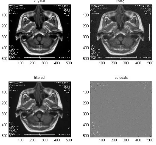 Fig. 1. Anisotropic Diffusion Filter a) Input Image b) Normalized Image c) ADF output 