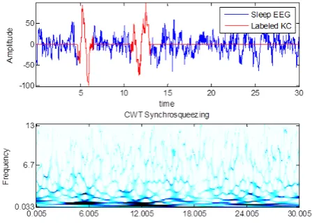 Fig. 1. An EEG signal containing two K-complexes (based on the expert’s scoring) and corresponding SST of the signal [15]