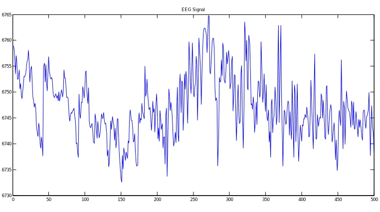 Figure 13:Standard EEG signal 2  