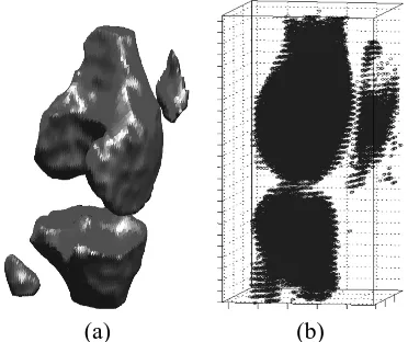 CTABLE IIILASSIFICATION (%) OF BONE (˜b) ACCORDING TO THE MASK FOR BONE (b) WITH K-MEANS, AND M-VTS