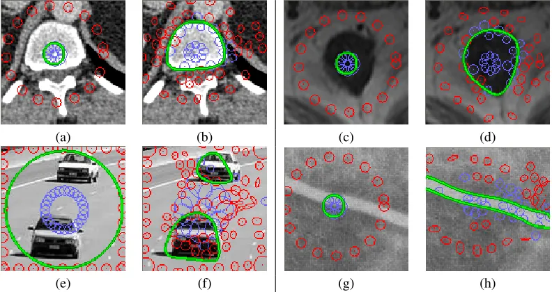 Figure 5. Segmentation of an ultrasound image. In (a) through (d), we show the evolution of anisotropic RBFs at different time steps untilconvergence (d).