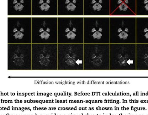Fig. 5 – A screen shot to inspect image quality. Before DTI calculation, all individual images are visually inspected to discard corrupted images from the subsequent least mean-square ﬁtting