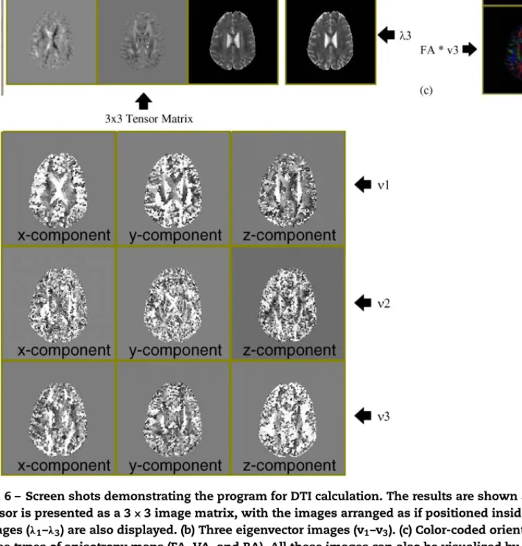 Fig. 6 – Screen shots demonstrating the program for DTI calculation. The results are shown as a plain-view mode