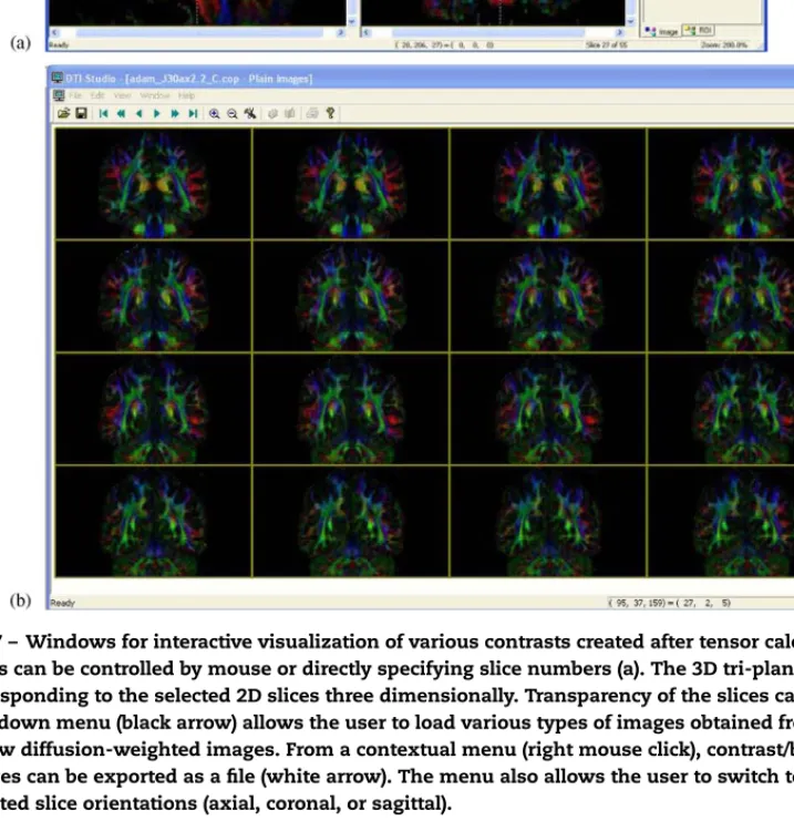 Fig. 7 – Windows for interactive visualization of various contrasts created after tensor calculation