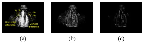 Fig. 1. Feature detection in a cardiac ultrasound image. Im-age (a), gradient (b), and J-divergence feature map (c) com-puted on the display image using the Fisher-Tippett method.Please see the digital version of the images for maximal qual-ity.