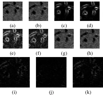 Fig. 2. Feature detection in synthetic ultrasound images. The top row shows the original synthetic ultrasound images withdiminishing contrast