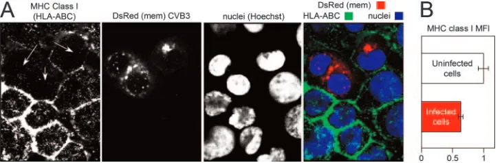 FIG. 2. Confocal microscopy conﬁrms reduced levels of MHC class I on the surfaces of CVB3-infected cells