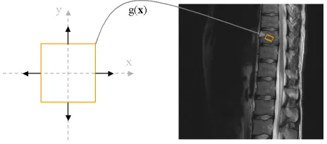 Figure 2. Our atlas shape in image Iis theunit square (left), transformed as a rectangleinto the imageI  (right) by a semi-afﬁne trans-ˆformation g ( x ) .