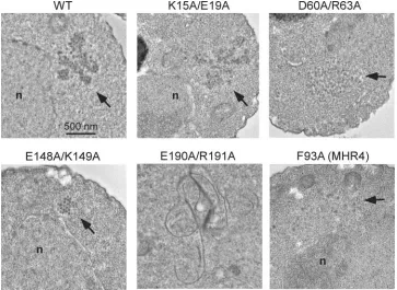 FIG. 9. EM of cells expressing Ty3 CA mutants. Cells transformed with the wt and Ty3 mutants K15A/E19A, D60A/R63A, E148A/K149A,E190A/R191A, and F93A (MHR4) were grown to log phase and induced for Ty3 expression for 6 h