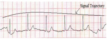 Fig. 2.Architecture diagram of the proposed ECG system 