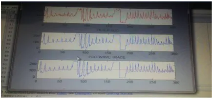 Figure 6 (a) Simulation result of halfband filter at 10000ns (b) Area Analysis of halfband filter (c) Power Analysis of (c)                                                                                   (d) the halfband filter (d)Timing Analysis of the halfband filter 
