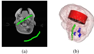 Fig. 1. A simple 2D graph for a 3x3 image (a) and its minimalcut (b). Figure based on [1].
