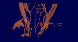 Fig. 4. Lymph node examples from the database.