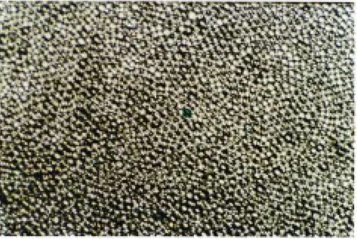 Figure 6. Positively stained bead (5-bromo-4-chloro-3-indolyl phosphate as substrate) in the middle of several thousands of negative (colorless) beads.