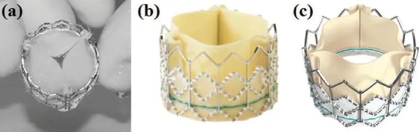 Figure 3. Evolution of the Cribier Edwards valve; (a) first generation equine pericardial valve,16 (b) SAPIEN valve and (c) the low profile SAPIEN XT valve, both with bovine pericardium (images courtesy of Edwards LifeSciences)