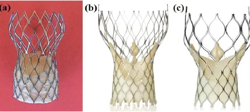 Figure 4. (a) First21 and (b) Third generation of the CoreValve® prosthesis and (c) CoreValve® EvolutTM prosthesis, (images with the courtesy of Medtronic)