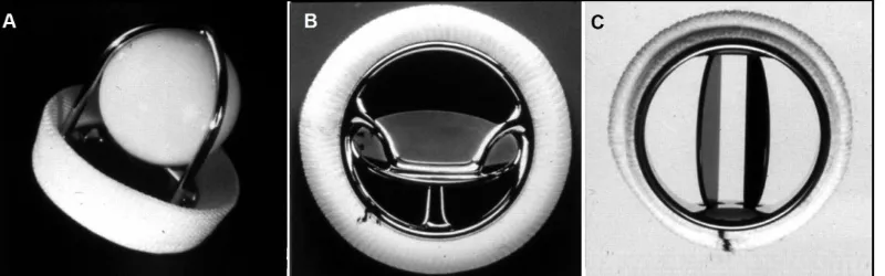 Figure 5.  Mechanical heart valves: a) ball and cage valve, b) tilting-disc valve and c) bileaflet valve.65