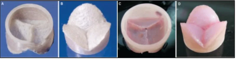 Figure 7.  Photographs of autologous tissue engineered valve (a) non-woven PGA scaffold coated with P4HB from the (a) aortic and (b) ventricular sides