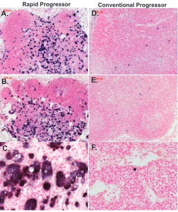 FIG. 4. Representative ﬁelds of view of ISH for SIV viral RNA in the mesenteric lymph nodes of RP and CP macaques