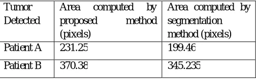 TABLE 1: Area computed by proposed method and by segmentation method of two patients. In this, we take 2 patients having tumor in the brain and we computed the area infected with the tumor of both the patients (in pixels) and compared the data with other  