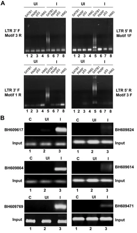 FIG. 2. ChIP-PCR analysis of DNA ﬂanking integration sites fromthe pool of SATB1-bound DNA