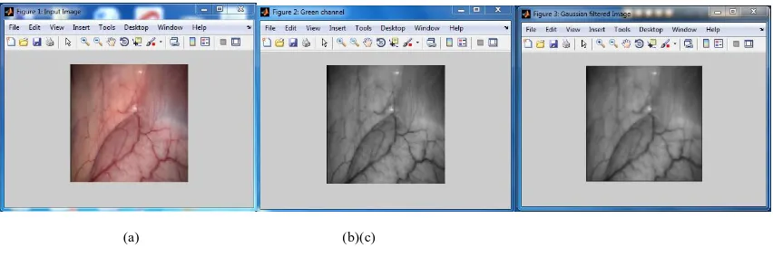 Fig. 2.(a) Original image (b) Image after  applying Green Channel Extraction (c) Image after applying Gussian filtered image 