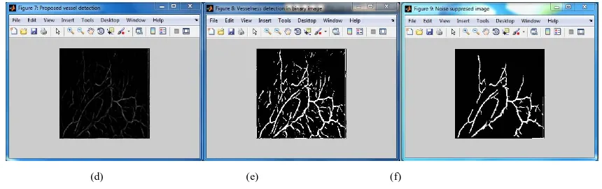 Fig. 3 (a) Enhanced Image (b) Eigen values of an image (c) Initial blood vessel detected image   