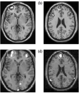 Fig. 9.4 Remarkable agreement between functional imaging method and study. Panels (a) and (b) show the rostral PFC regions identified as important for source memory using fMRI by Simons et al