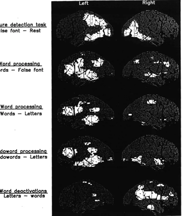 Figure 2. The regions where there were significant changes in cerebral blood flow during feature detection, word processing, and pseudoword processing are illustrated in white on green models of the left and right hemispheres of the brain.