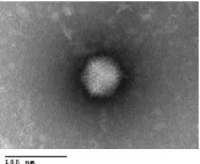 FIG. 1. Transmission electron micrograph of isolated HAdV-52.Note that the virus has a typical icosahedral shape and is roughly 70