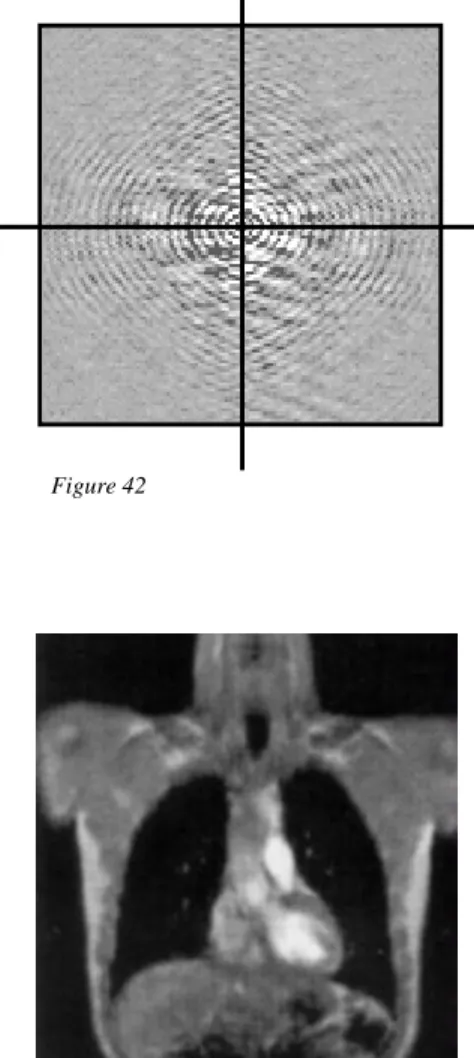 Figure 42     } } }  Resolution    Resolution     S/N &amp; Contrast     Figure 43    Central part  only  A  B  Figure 44   