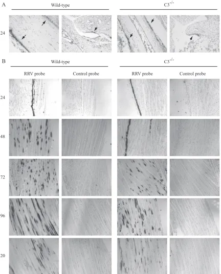 FIG. 4. RRV infection in hind limb bone, joint, and skeletal muscle. Twenty-four-day-old C57BL/6J wild-type or C3�10riboprobe complementary either to RRV or to the EBER2 gene from Epstein-Barr virus (control probe)