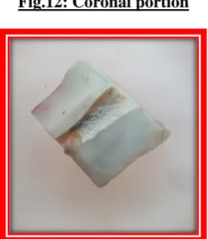 Fig.12: Coronal portion 