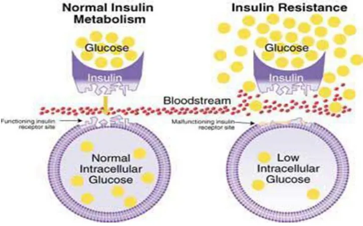 Figure No.7. Insulin Resistance 