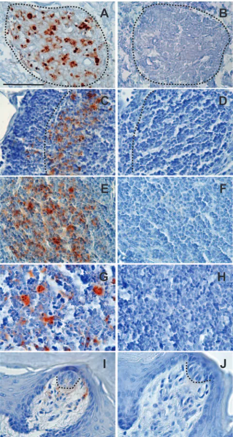 FIG. 1. Deposition of PrPd(A, C, E, G, and I) and mock-infected (B, D, F, H, and J) hamstersat 22 weeks after e.n