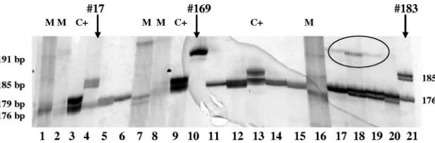 FIG. 1. E2-HVR1 ampliﬁed PCR products analyzed by denaturing PAGE. Lanes: 1, 2, 7, 8, and 16, molecular markers; 3, 9, and 13, 176-bpand 179-bp positive controls; 4, result for patient 17 (genotype 1b; cryoglobulin negative) showing two bands corresponding to mutated (insertion