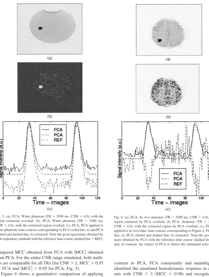 Figure 6 shows a quantitative comparison of applying PCA and FCA to the in vivo data. Again, using PCA, the positively and negatively correlated time-courses were not discriminated and we compared MCC obtained by FCA with 兩MCC兩 obtained by PCA