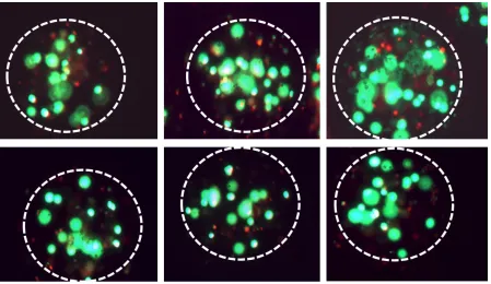 Figure shows six randomly chosen microbeads from the culture on Day 6. Green blobs show Figure 4-5: Qualitative assessment of viability using LIVE/DEAD assay the stained cytoplasm of Live cells whereas red dots represent the stained nuclei of Dead cells
