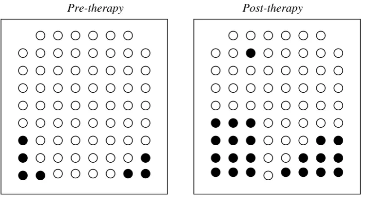 Figure 2: Pre and post therapy EPG displays showing maximum contact for /k/ in ‘car’ 