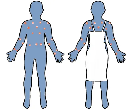 Fig.  anapronsites). The two sets of samples were analysed         (termed    had wearing    ‘with   15 apron’thesamplingsitesbeenleftexposediftheHCW therighthighlights on image    The  onthe front of HCW gowns.The image  onthe leftshows  thepositions   of