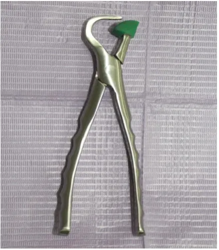 Fig 3.Left maxillary posterior physics forceps 