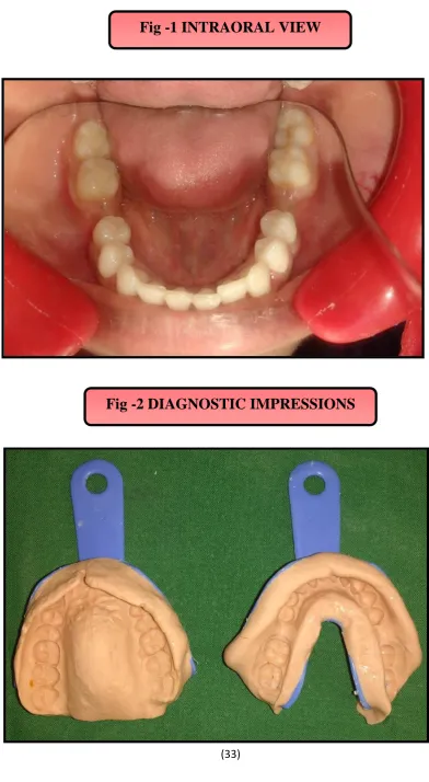 Fig -1 INTRAORAL VIEW 