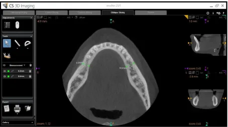 Fig -5 PANOROGRAM 