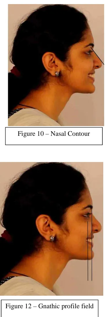 Figure 10 – Nasal Contour 