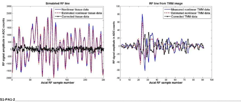 Figure 1b displays a pulse inversion RF line of measured nonlinear TMM signal, estimated nonlinear signal and corrected signal