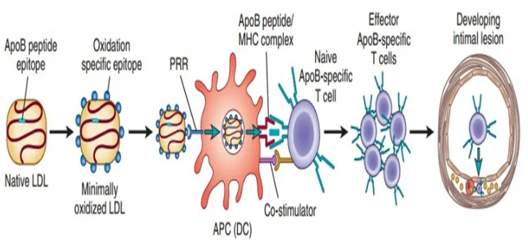 Figure 2 Role for LDL as an antigen promoting atherosclerosis 